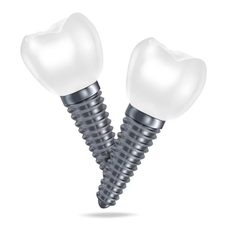 Trụ Implant: Giải Pháp Phục Hồi Răng Mất Tối Ưu Và Toàn Diện