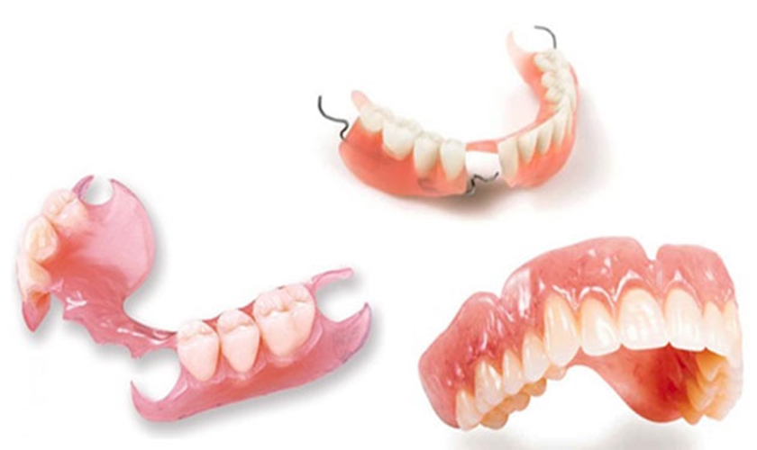 Trồng răng hàm giả tháo lắp: Chi phí, ưu điểm, nhược điểm và câu hỏi thường gặp