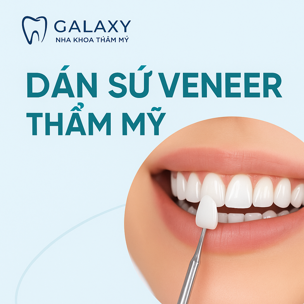 Dán Sứ Veneer Thẩm Mỹ – Giải Pháp Cho Nụ Cười Tự Nhiên